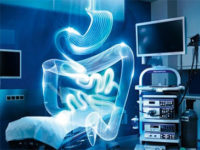 Колоноскопия