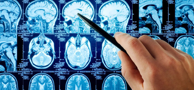 Неврологическое отделение ОНМК